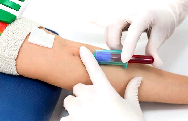 Blood Test for Detecting Cancer